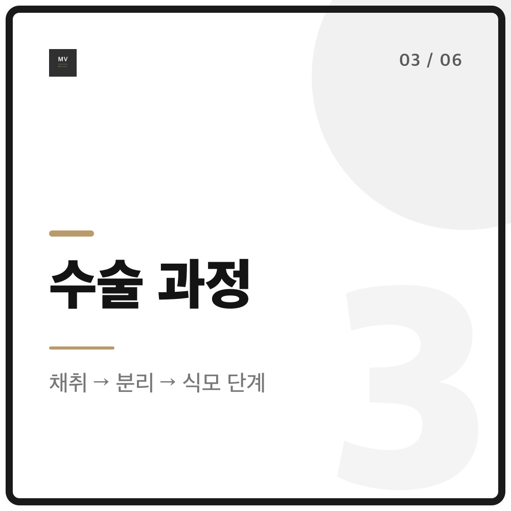 채취에서 분리, 식모로 이어지는 모발이식 수술 과정 단계